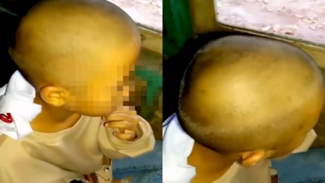 Tua Gegara Banyak Kutu